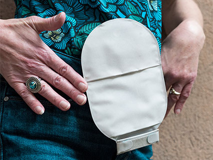 UniPectine for Ostomy Sell Sheet UniPectine for Ostomy Sell Sheet